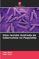 Uma revisão ilustrada da tuberculose no Paquistão (Portuguese Edition) 6208599709 Book Cover