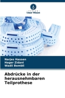 Abdrücke in der herausnehmbaren Teilprothese (German Edition) 6208772990 Book Cover