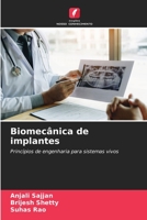 Biomecânica de implantes: Princípios de engenharia para sistemas vivos 6206137821 Book Cover