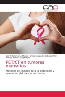 PET/CT en tumores mamarios 6203032204 Book Cover