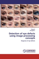 Detection of eye defects using image processing concepts 6200503206 Book Cover