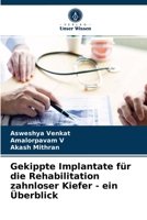 Gekippte Implantate für die Rehabilitation zahnloser Kiefer - ein Überblick 6203617040 Book Cover