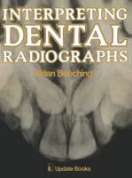 Interpreting Dental Radiographs 940118027X Book Cover