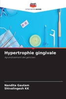 Hypertrophie gingivale: Agrandissement des gencives 6204135376 Book Cover