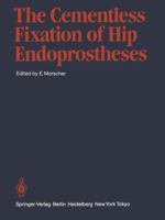 The Cementless Fixation of Hip Endoprostheses 3642690084 Book Cover