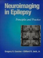 Neuroimaging in Epilepsy 0750697164 Book Cover