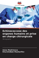 Echinococcose des organes humains et prise en charge chirurgicale (French Edition) 620974138X Book Cover