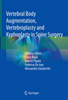 Vertebral Body Augmentation, Vertebroplasty and Kyphoplasty in Spine Surgery 3030765547 Book Cover