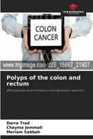 Polyps of the colon and rectum: Effectiveness and limitations of endoscopic resection 6202940271 Book Cover