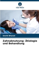 Zahnabnutzung: Ätiologie und Behandlung (German Edition) 6208396875 Book Cover