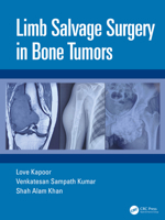 Limb Salvage Surgery in Bone Tumors 0367421305 Book Cover