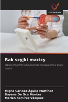 Rak szyjki macicy (Polish Edition) 6208983592 Book Cover