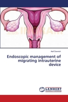 Endoscopic management of migrating intrauterine device 3659548405 Book Cover