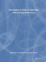 Dermatoses in Dark Vs Light Skin: Differing Clinical Manifestations 103276273X Book Cover