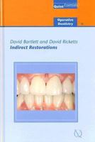 Indirect Restorations 1850970785 Book Cover