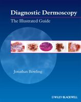 Diagnostic Dermoscopy: The Illustrated Guide 1405198559 Book Cover