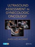 Ultrasound Assessment in Gynecologic Oncology 1138044326 Book Cover