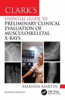 Clark’s Essential Guide to Musculoskeletal X-ray Interpretation for Radiographers: Evaluating and Commenting on Images (Clark's Companion Essential Guides) 1032832924 Book Cover