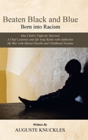 Beaten Black and Blue: Born into Racism 1665580224 Book Cover