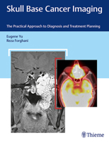 Skull Base Cancer Imaging: The Practical Approach to Diagnosis and Treatment Planning 1626232962 Book Cover