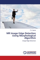 MR Image Edge Detection Using Morphological Algorithm 6203307424 Book Cover