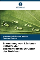 Erkennung von Läsionen mithilfe der segmentierten Struktur der Netzhaut (German Edition) 6208239362 Book Cover