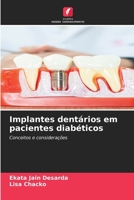 Implantes dentários em pacientes diabéticos (Portuguese Edition) 6202363762 Book Cover