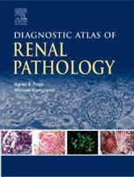 Diagnostic Atlas of Renal Pathology: A Companion to Brenner and Rector's The Kidney 7E 1416028714 Book Cover