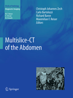 Multislice-CT of the Abdomen 3642178626 Book Cover