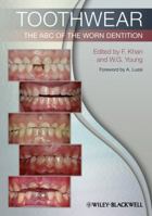 Toothwear: The ABC of the Worn Dentition 144433655X Book Cover