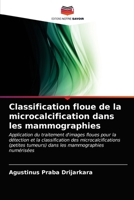 Classification floue de la microcalcification dans les mammographies 6202947004 Book Cover