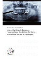 Les cellulites de l'espace masticateur d'origine dentaire 3841634354 Book Cover