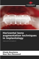 Horizontal bone augmentation techniques in implantology 6208253594 Book Cover