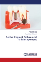 Dental Implant Failure and its Management 6205639165 Book Cover