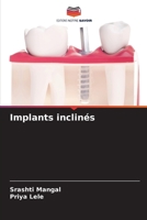 Gekippte Implantate (German Edition) 6207806891 Book Cover
