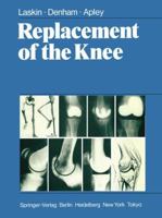 Replacement of the Knee 1447113551 Book Cover