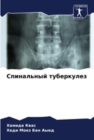 Спинальный туберкулез 6205979004 Book Cover