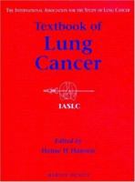 Textbook of Lung Cancer 1853177083 Book Cover