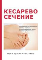 Kesarevo Sechenie 5519623643 Book Cover