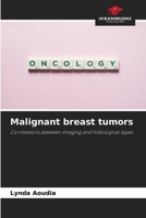 Malignant breast tumors 6207681568 Book Cover