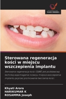 Sterowana regeneracja kosci w miejscu wszczepienia implantu (Polish Edition) 6200711038 Book Cover