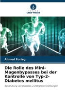 Die Rolle des Mini-Magenbypasses bei der Kontrolle von Typ-2-Diabetes mellitus (German Edition) 6208591163 Book Cover