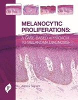 Melanocytic Proliferations: A Case-Based Approach to Melanoma Diagnosis 1907816976 Book Cover