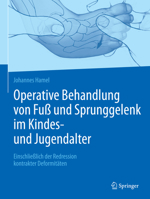 Operative Behandlung von Fuß und Sprunggelenk im Kindes- und Jugendalter: Einschließlich der Redression kontrakter Deformitäten 3662565919 Book Cover