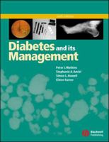 Diabetes and Its Management 1405169273 Book Cover