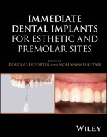 Immediate Dental Implants for Esthetic and Premolar Sites 1394187106 Book Cover
