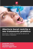 Abertura bucal restrita e seu tratamento protético (Portuguese Edition) 6206515656 Book Cover