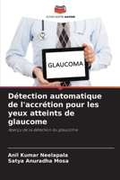 Détection automatique de l'accrétion pour les yeux atteints de glaucome: Aperçu de la détection du glaucome 6206010120 Book Cover