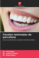 Facetas laminadas de porcelana: Uma nova dimensão na medicina dentária estética 6206246760 Book Cover