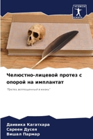Челюстно-лицевой протез 620728254X Book Cover